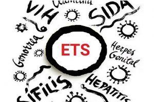 ETS