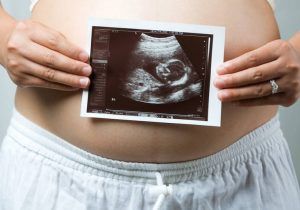 El aborto es constitucional.